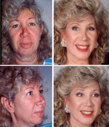 Extreme Makeover