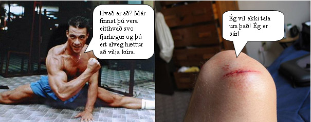 annar balur.....