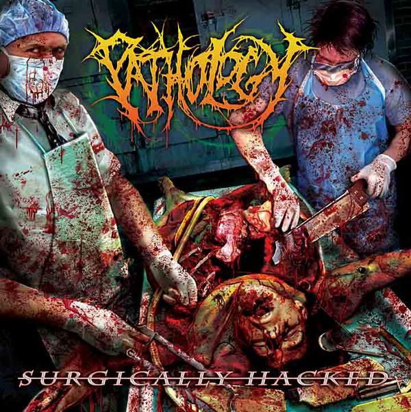 Pathology - Surgically Hacked