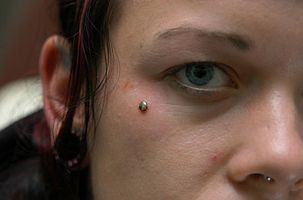 Dermal anchor piercing!