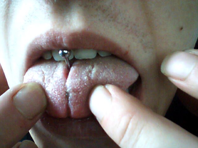 Tie-off Tounge-split dagur 9
