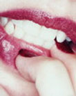 Metall