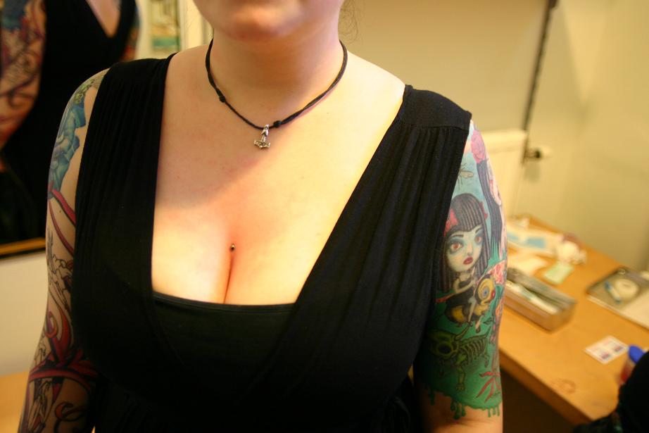 Dermal Anchor