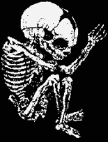 Metall